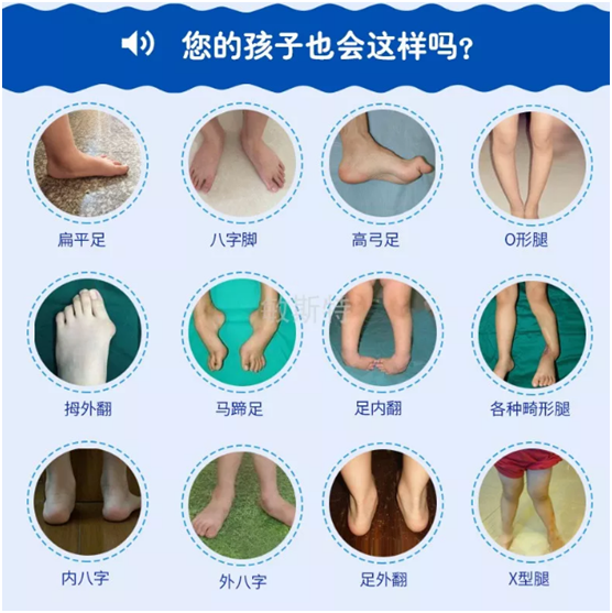 耐樂(lè)途功能鞋 關(guān)注兒童足部健康